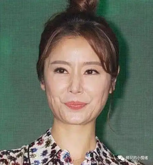 43岁林心如近照曝光,满脸横肉尽显老态,网友:委屈霍建华了__凤凰网