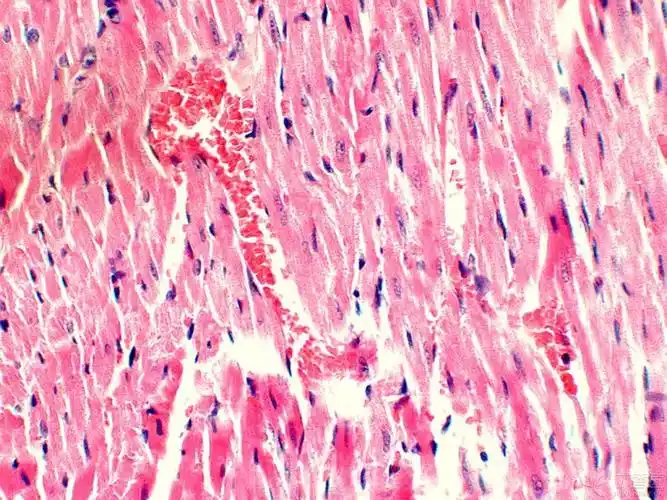 【求助】心肌梗死he染色