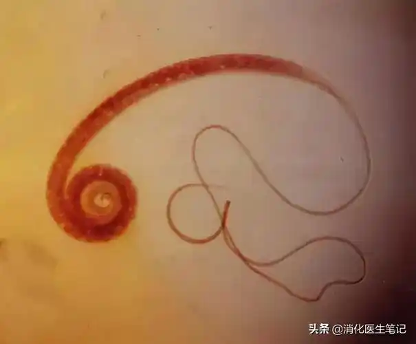 寄生人体的肠道寄生虫主要有蛔虫,鞭虫,钩虫,蛲虫等四种寄生虫.