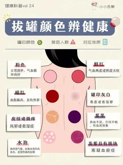 拔罐最全养生指南73不同颜色辨健康78养生必看