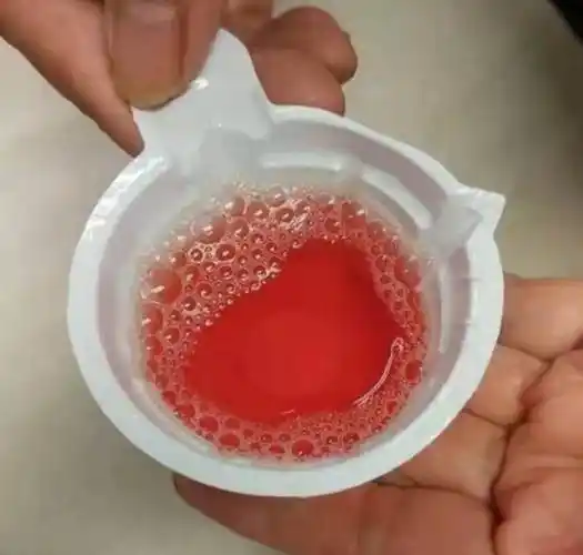 a1:每天早上观察自己排出的尿液是否出现尿色变化,如肉眼血尿,茶色尿