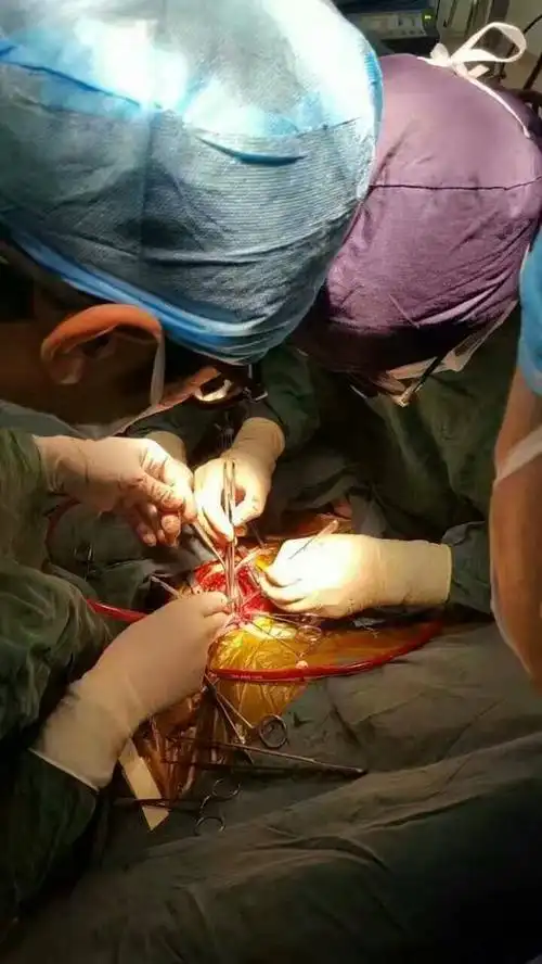 手术照片