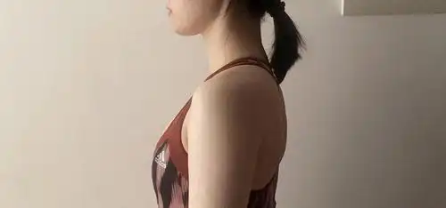 肩正面没有明显问题,但侧面看起来非常厚,背面看蝴蝶骨突出.