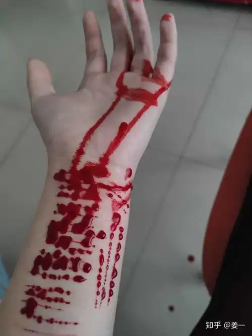 自残的人真的很令人讨厌吗?