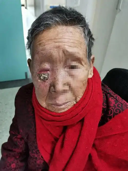 登封市人民医院肿瘤放疗科的美篇