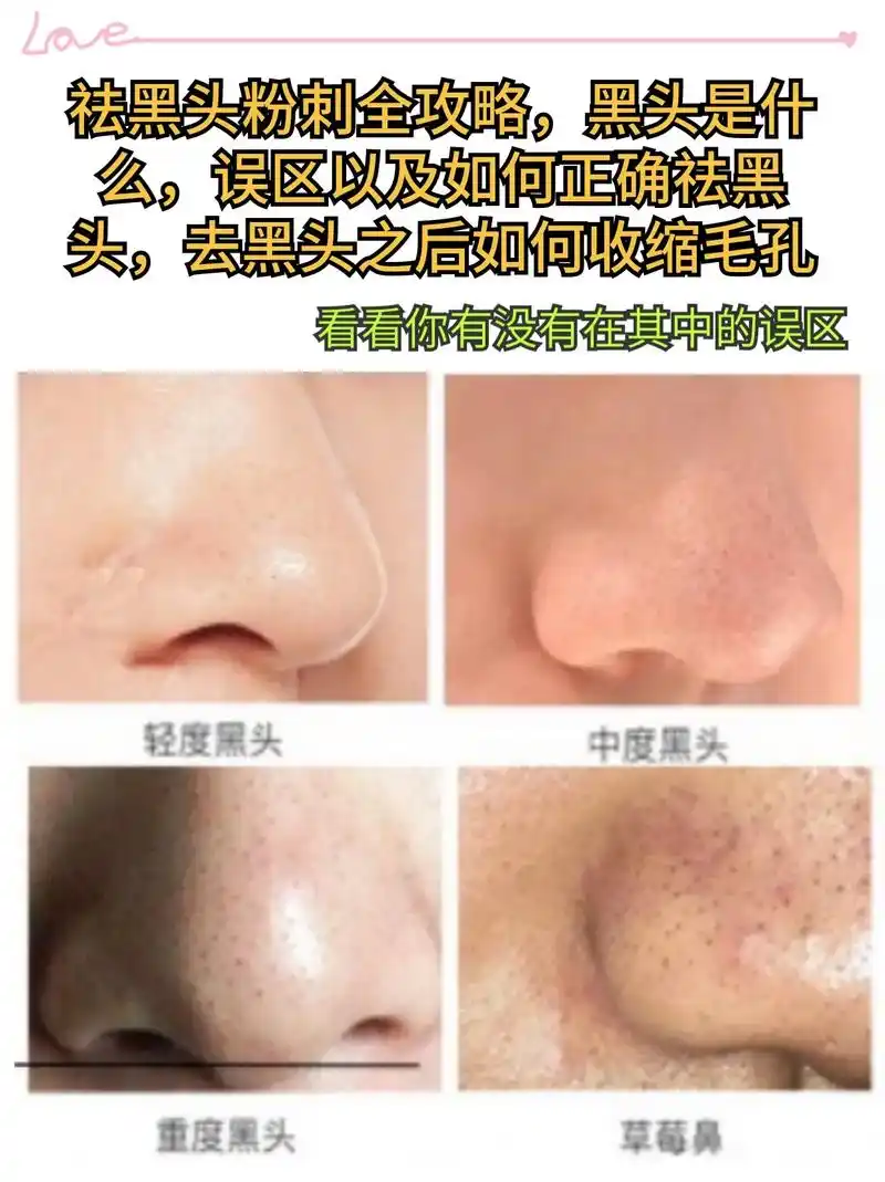 今天教你怎么去高效祛黑.今天来聊聊护肤界的 - 抖音