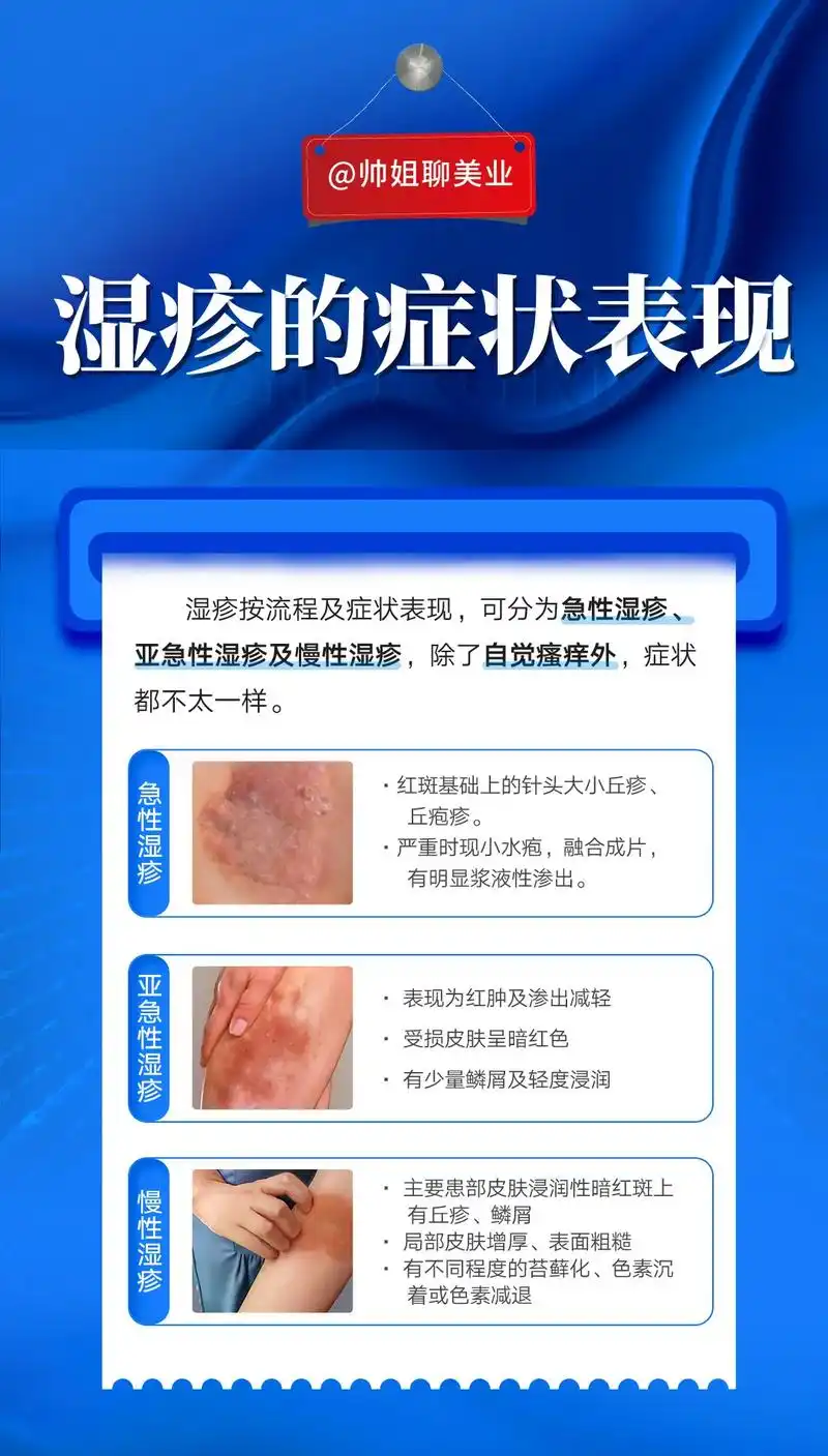 湿疹怎么治疗 反复发作怎么办?湿疹病因复杂,常为内外因相互 - 抖音