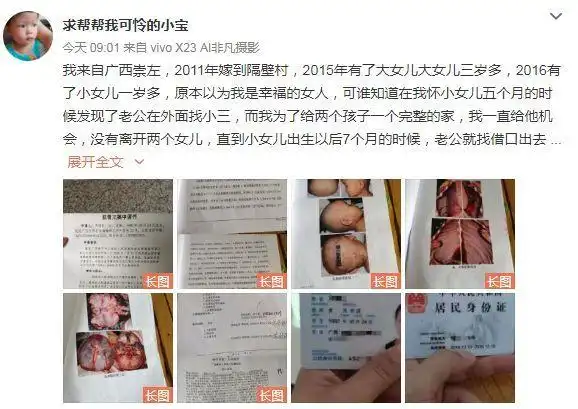 广西一岁半女童在爸爸的出租屋内不幸身亡,尸检报告显示身上多处针孔