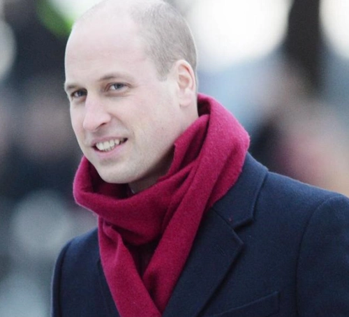 英国王室终于要与"秃头"说再见了,哈里王子投下重金保护脑袋