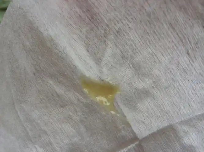 每天都有这样的黄色痰,请问这样上火的三周岁小孩可以长期喝什么中药