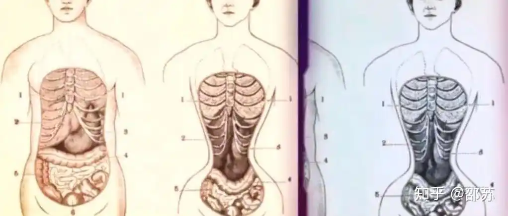 你被束腰"害"了吗?