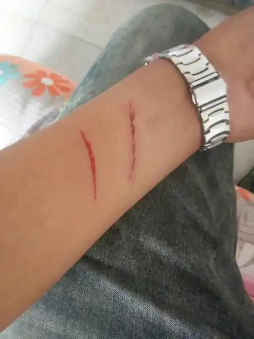 【23】身体上有伤口,不要涂抹或者让伤口沾到粉状物,这样的情况会造成