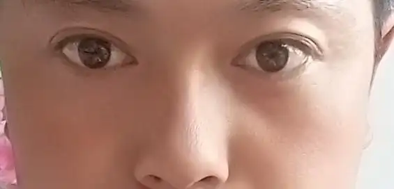我拍出照片来很丑,眼睛一高一低双眼皮一宽一窄