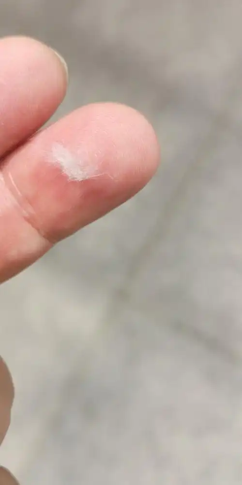 满天飞舞的棉絮虫