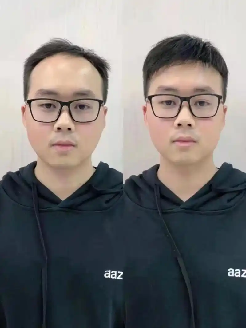 图1男士戴假发前后对比 头发一秃,显老20岁不止! 男性朋友 - 抖音