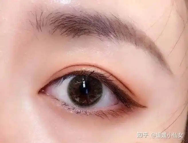 新月双眼皮就是在内眦,外眦靠近重睑线,睑中间部分款,看起来像一轮