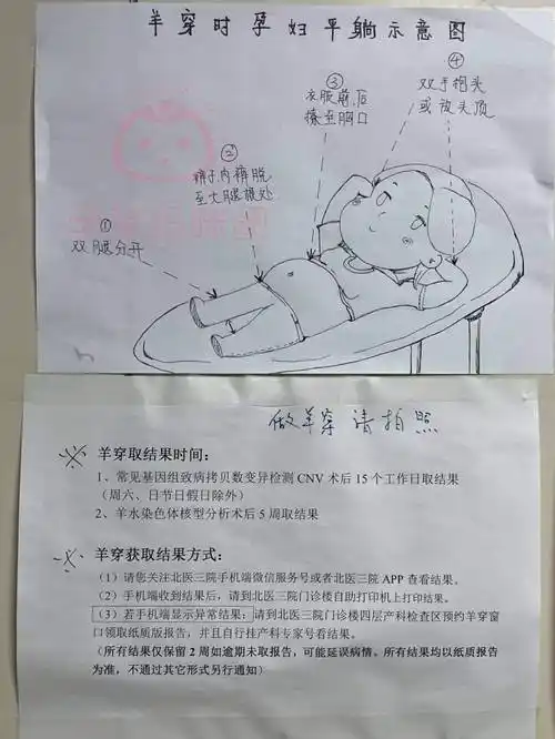 北医三院产检|羊穿经历分享_手术_医生_结果