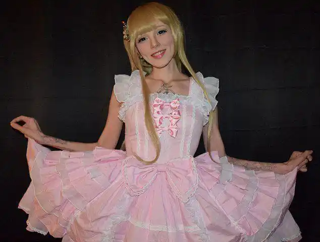 女孩因患肌萎缩症变真人版芭比娃娃