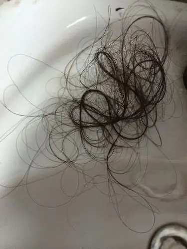 你们有谁像我这样掉头发掉得这么恐怖的啊?你们有什么治的办法啊?