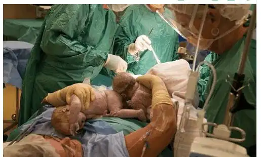 让你瞬间看懂顺产分娩全过程到底是怎样的, 准妈妈们害怕了吗?