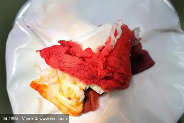 医院垃圾桶里血迹斑斑的绷带