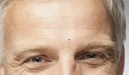 痣相图解男人印堂有痣代表什么印堂长痣的男人面相图解