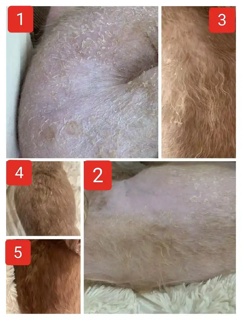 无菌性干性脂溢性皮炎