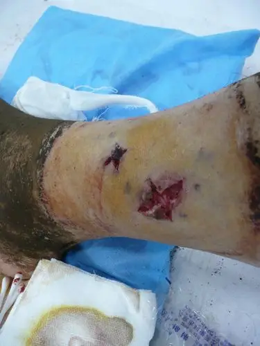 标题:转帖:《我被毒蛇咬了!》