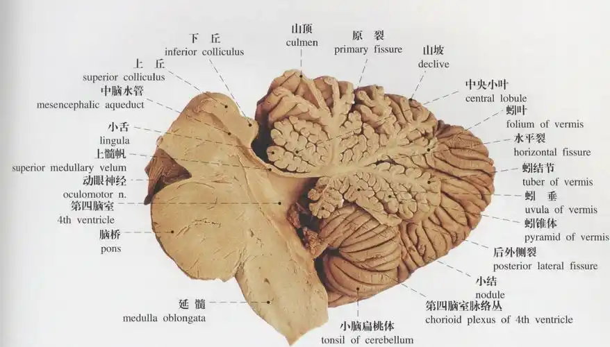 图515 小脑(正中矢状切面)-人体解剖学标本-医学