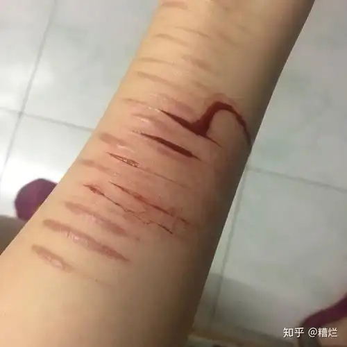 自残的人是不是很傻