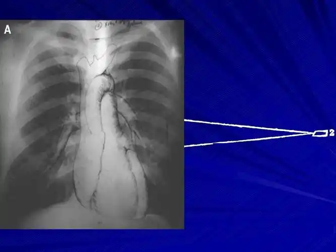 心脏及大血管影像诊断第一部分ppt