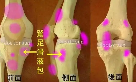 由于三个肌腱有致密的纤维膜相连,形同鹅足而得名