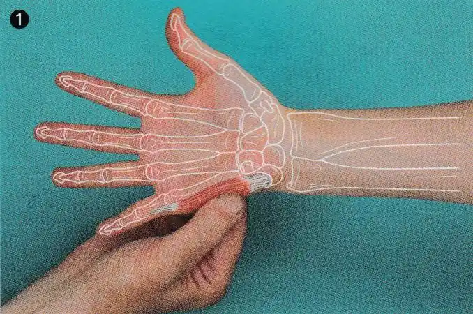 康复触诊新章节-62小指展肌(下)