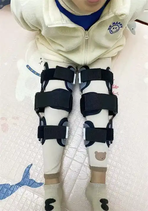 o型腿/膝内翻/小腿外翻(左腿) 单只 s【图片 价格 品牌 报价】-京东