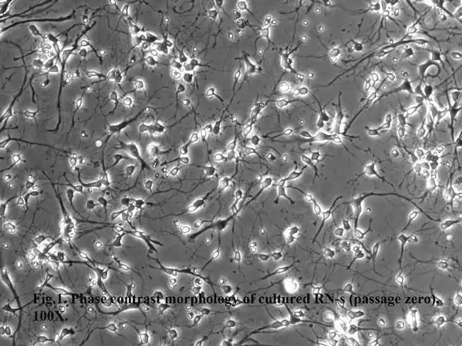 大鼠纹状体神经元