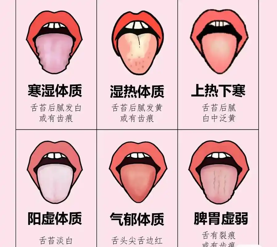 舌诊图解速查大全.#舌诊科普 #舌诊学习 #舌诊知识 - 抖音