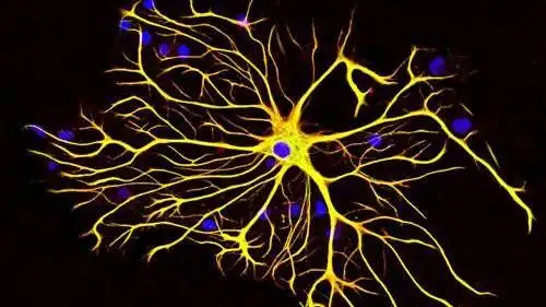 星形胶质细胞瘤细胞 - 知乎