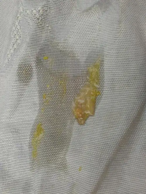 宝宝今天拉了一些白色的屎,跟胶似的,也没有别的不适反应.