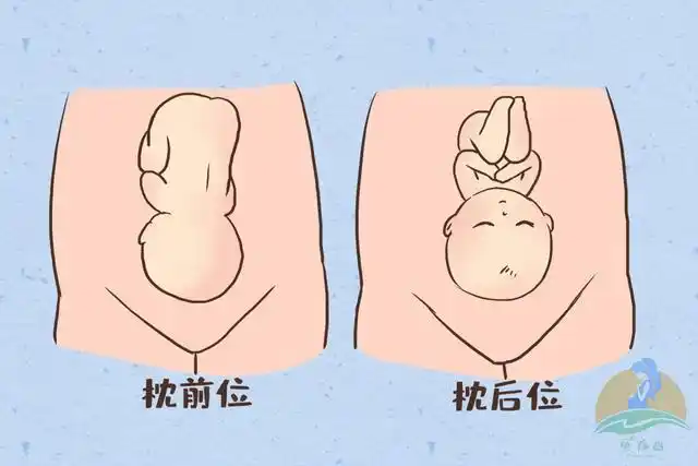 枕前位和枕后位