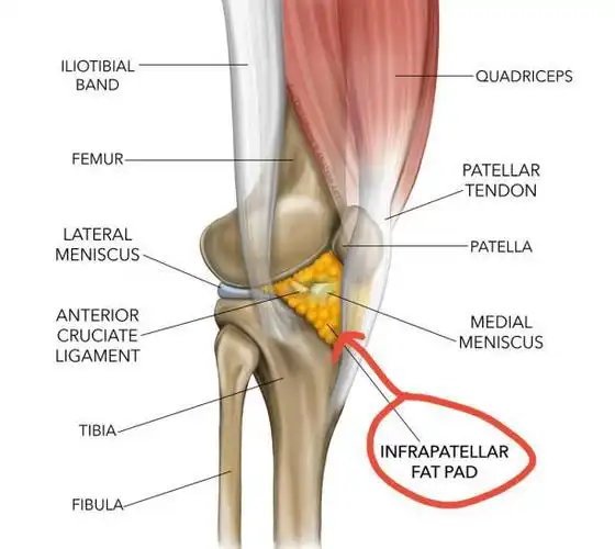 髌下脂肪垫损伤