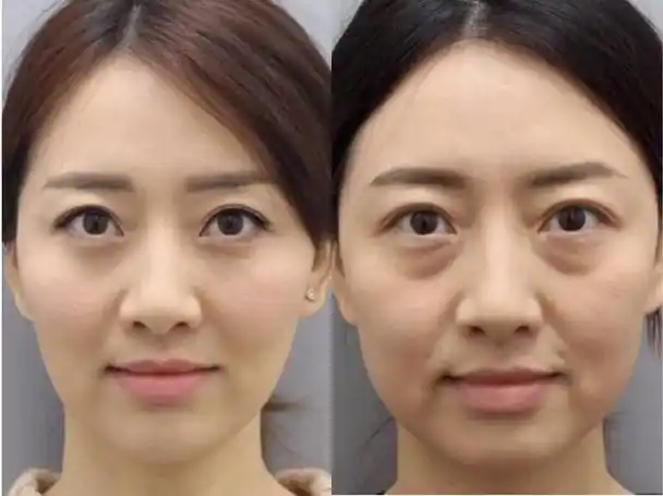 金晨每一次出现在公众面前,许多人都会被她的美貌所折服!