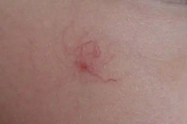 十有八九是肝硬化_肝脏_大腿_身体