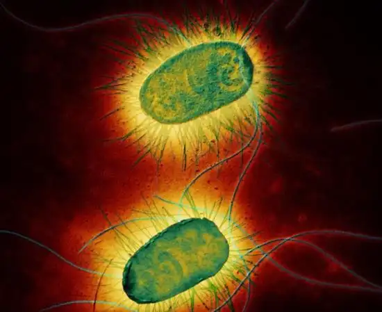 西伯利亚发现史前巨型病毒 揭致命病菌真面目