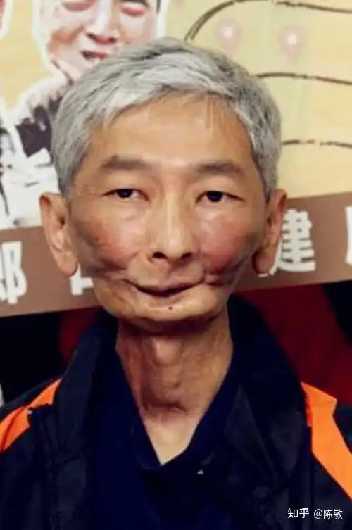 长期嚼槟榔有哪些危害? - 知乎