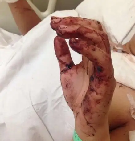 上海发生同居室友砍人事件被砍者浑身是血