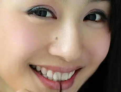 1,女人山根有痣主病灾,火灾等意外,婚姻不利,山根左边有痣,为有异性