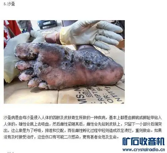 还能再恶心一点吗?