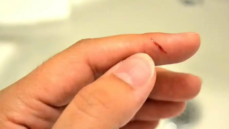 被纸张划伤手指时,伤口明明很浅,为什么会感到十分疼痛呢?