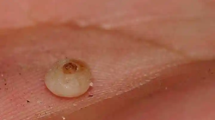 像原住民或古罗马奴隶角斗士一样长期赤脚有什么需要注意的吗?