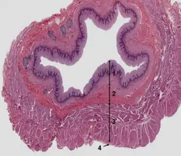 食管光镜像,请判断图中4所示的是食管壁的哪一层?()